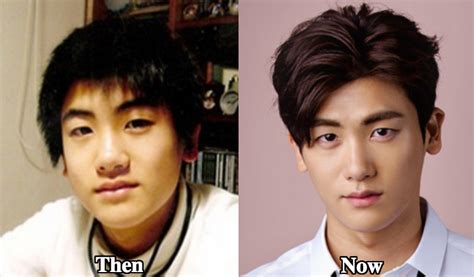 park hyung sik|park hyung sik without makeup.